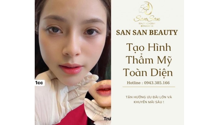 SAN SAN BEAUTY CHƯƠNG TRÌNH SIÊU ƯU ĐÃI DỊCH VỤ FILLER CHỈ CÒN 999K/1cc C.ấ.y Collagen HA chỉ #999k 1cc Địa chỉ: 137/1 Ngô Quyền, Phường 6, Quận 10.